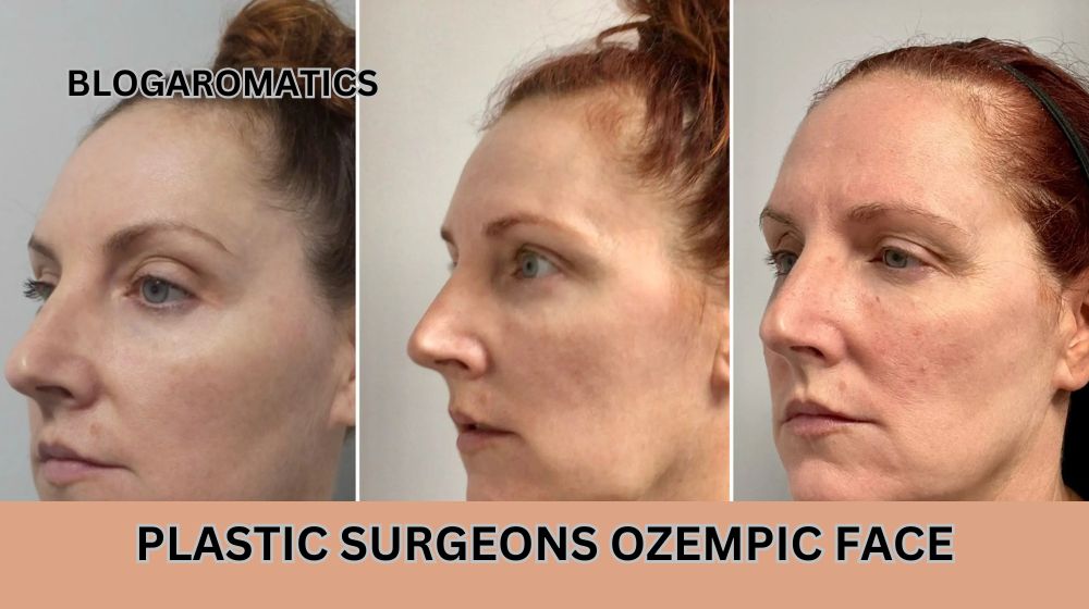 Plastic Surgeons Ozempic Face